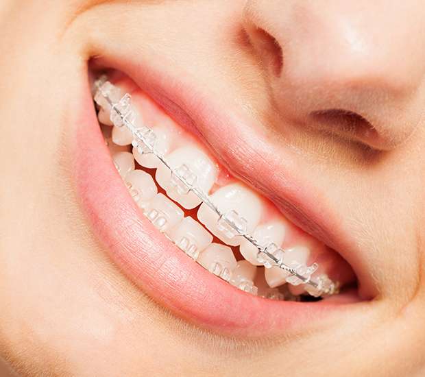 Glendale Invisible Orthodontics