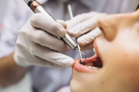 dental emergency in glendale