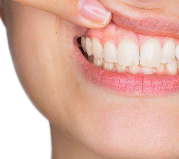 Gum Disease Glendale, CA