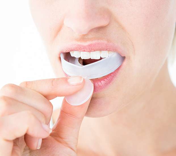 Glendale Mouth Guards
